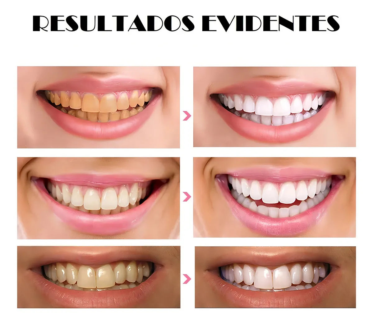 Polvo Blanqueador De Dientes