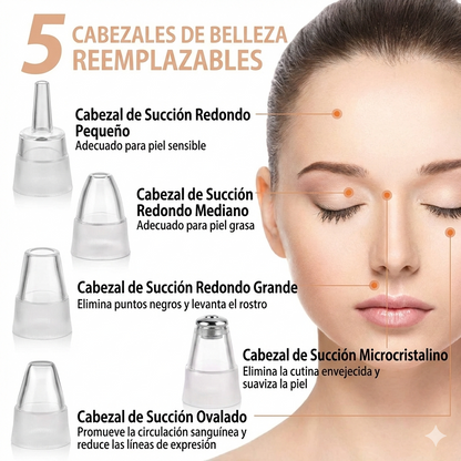 Extractor de puntos Negros